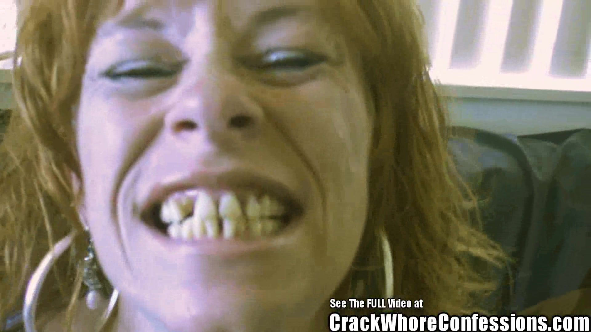 FreeBlackToons Donkey Teeth Red Head mom Crack Slut Cachonda